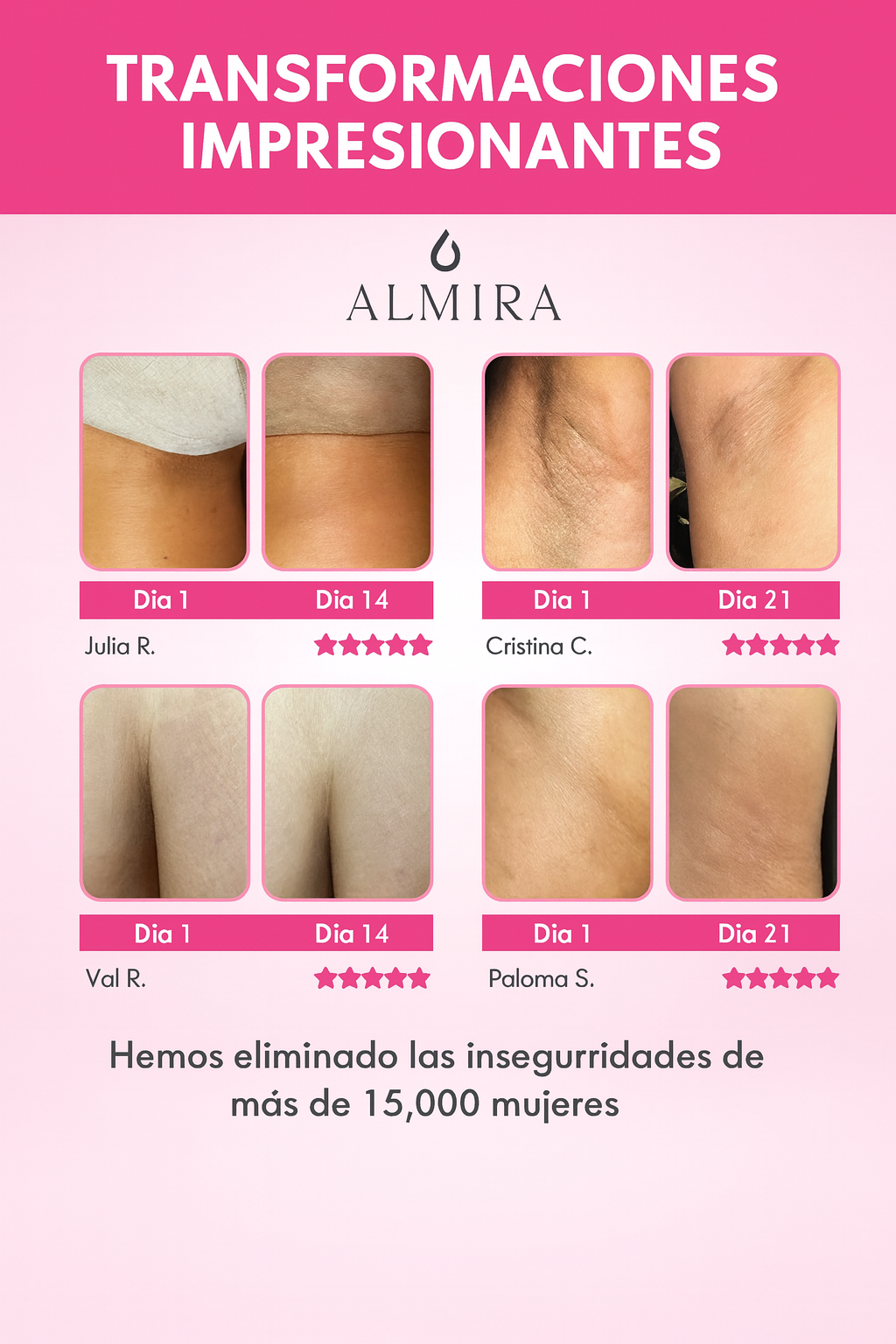 SKINGLOW-CREMA ACLARANTE