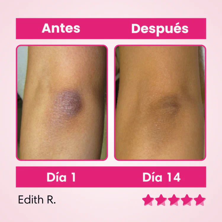 SKINGLOW-CREMA ACLARANTE